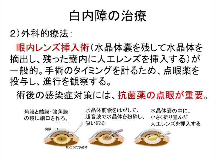 第1部:眼の構造と機能 ・ 前眼部疾患病態と治療