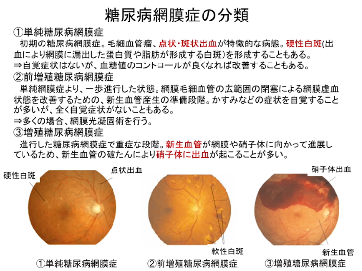第2部:後眼部疾患の病態と治療