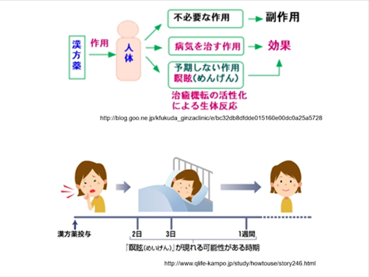 第3部:漢方薬の副作用