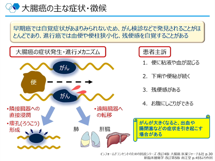 第1部:大腸癌の基礎講座