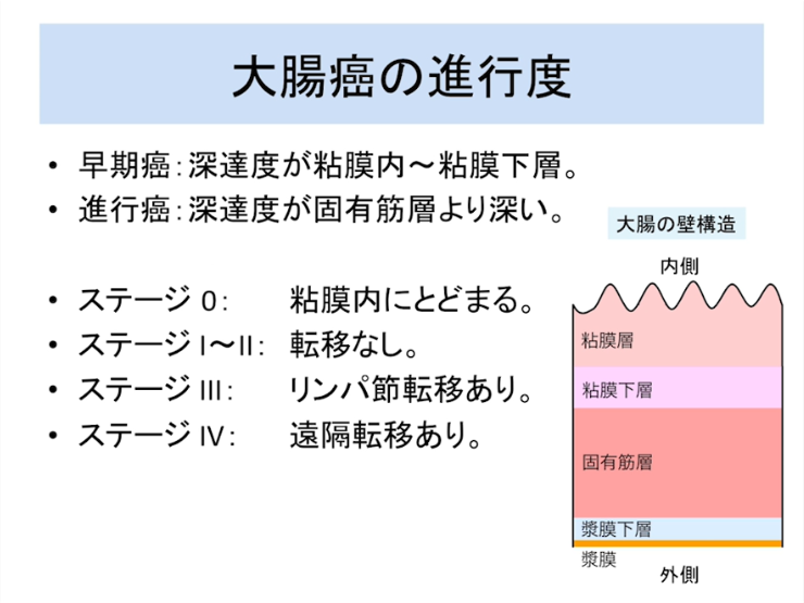 第2部:大腸癌の診断と外科治療について