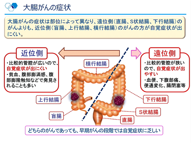 直腸がん患者への支援