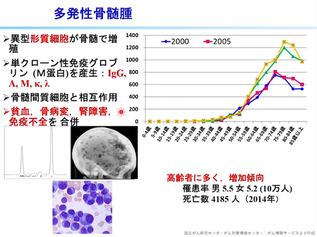 薬剤師も知っておきたい血液がんの基本 血液疾患の基礎知識と薬物療法の画像Ⅰ