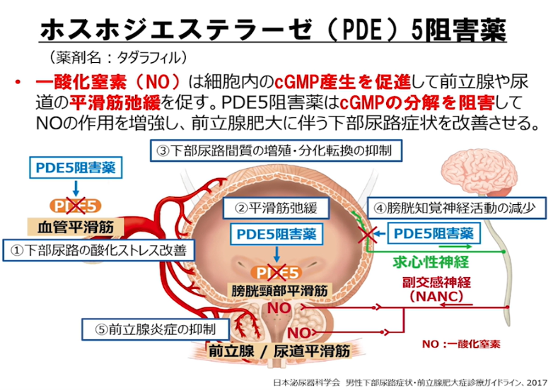 下部尿路症状(LUTS)に対する薬物療法の画像