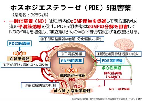 下部尿路症状(LUTS)に対する薬物療法の画像