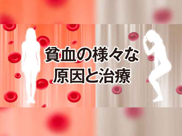 貧血の原因とは?種類と治療法を解説の画像