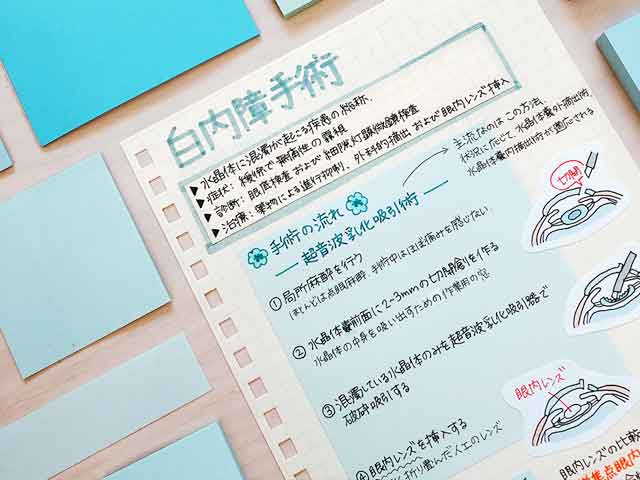 知っておきたい白内障の手術|服薬指導に役立つの画像